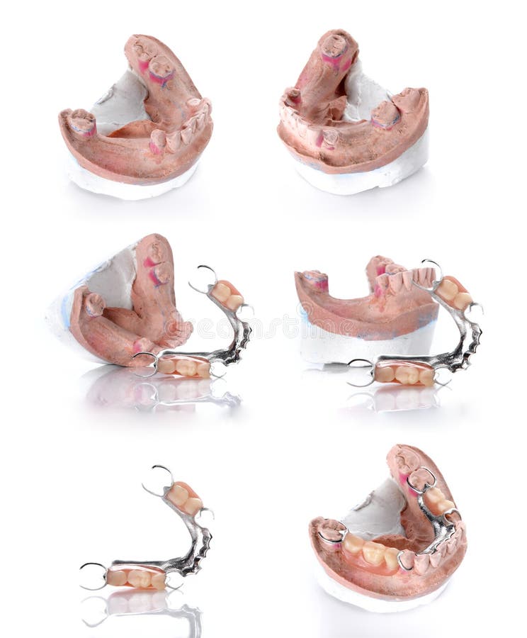 Collection Denture mold,false teeth isolated on white background. Collection Denture mold,false teeth isolated on white background.