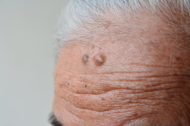 Older Hairy Nudist Women Stock Photos - Free & Royalty-Free Stock Photos from Dreamstime