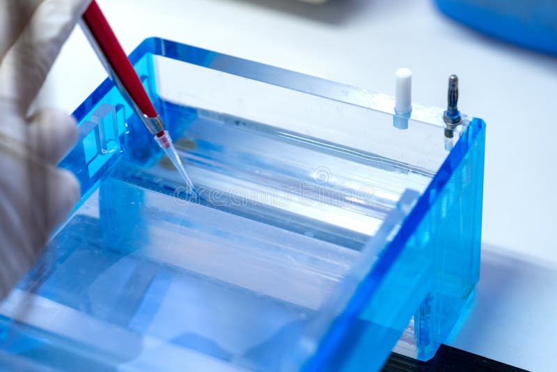Molecular technique gel electrophoresis for DNA sample method decrypt the genetic code. biochemistry and clinical chemistry in laboratory. Gene sequence stock images, royalty-free photos and pictures
