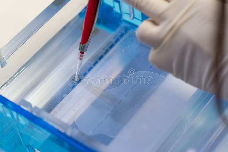 Molecular Technique Gel Electrophoresis for DNA Sample Method Decrypt