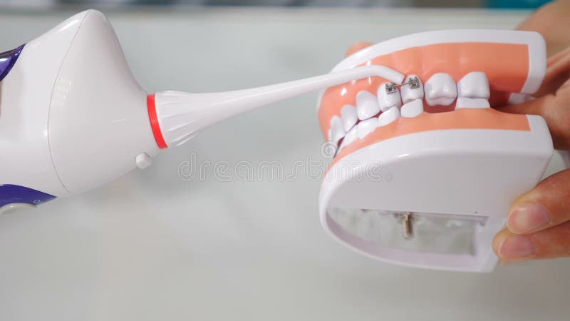 Mondhygiëne voor tandheelkundige beugels. orthodontisch behandelingsconcept. tandheelkunde. tandarts toont hoe je tanden kunt rein