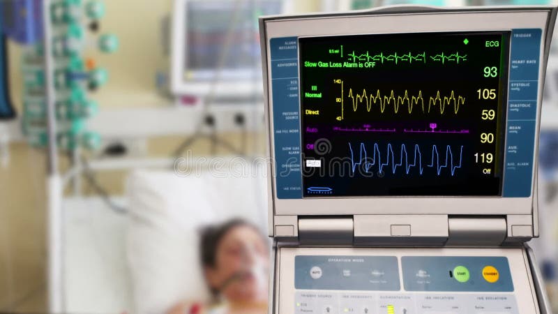 Moniteur d'ECG et counterpulsation intraaortic de ballon