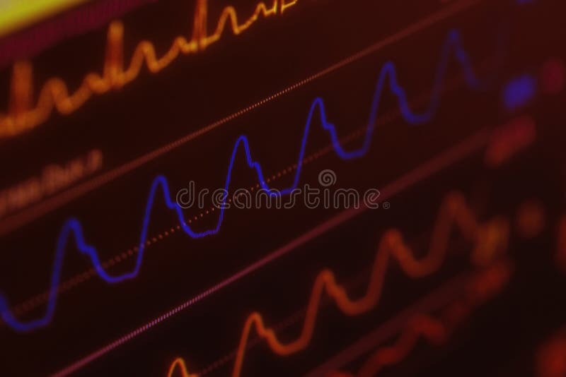 Monitor medico di battito cardiaco, concetto della minaccia contro vita