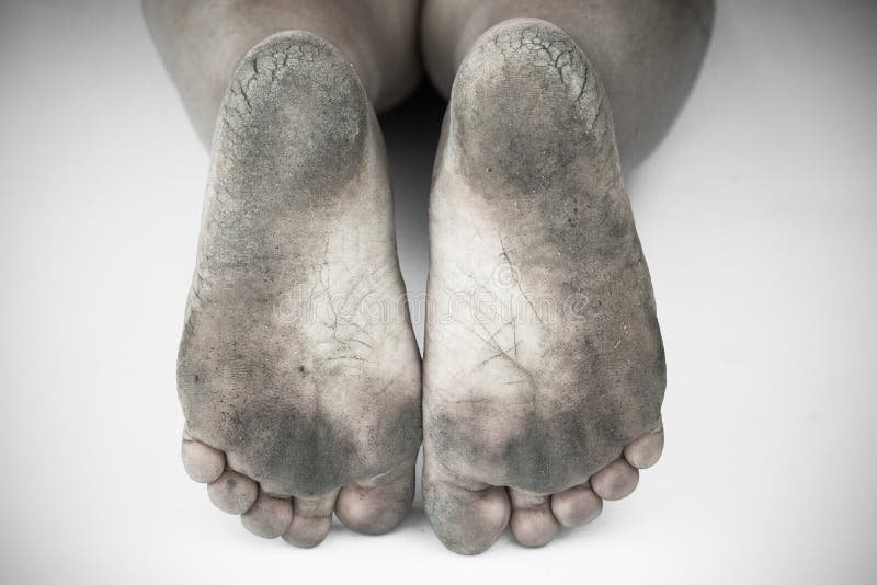 5,500+ Ugly Feet Stock Photos, Pictures & Royalty-Free Images