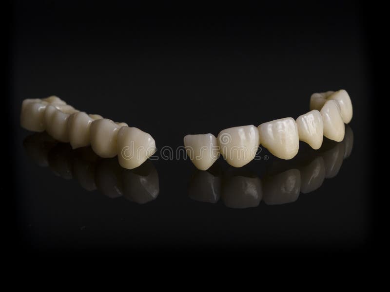 Monolithic Zirconia Restorations Full Arch Implant Supported Wit Stock