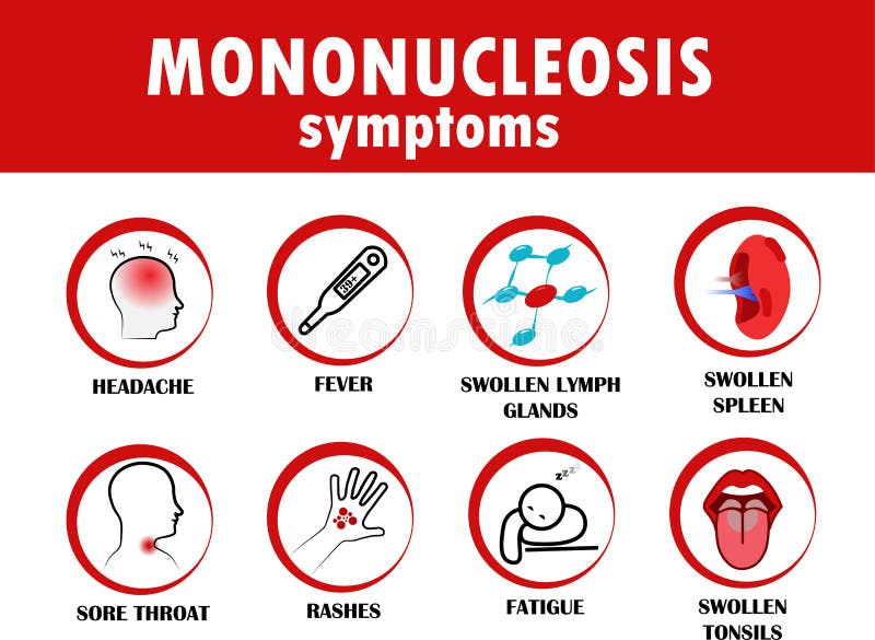 Mononucleosis symptoms.  Flat style vector illustration isolated on white background