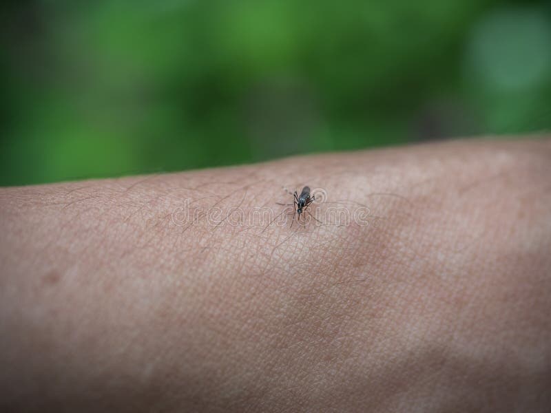 Mosquito Biting In The Arm Stock Photo Image Of Pain 117882224