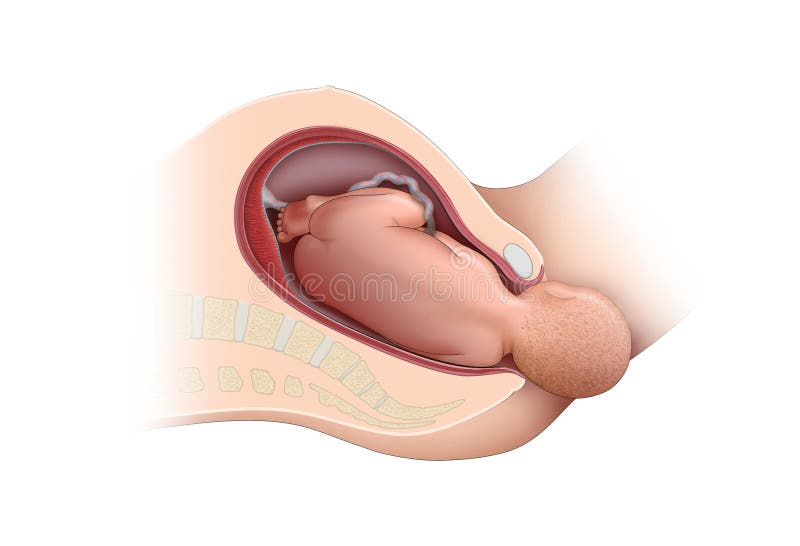 Vaginal Delivery Stock Illustrations – 79 Vaginal Delivery Stock Illustrations, Vectors & Clipart - Dreamstime Vaginal Delivery Stock Illustrations – 79 Vaginal Delivery Stock Illustrations, Vectors & Clipart - Dreamstime