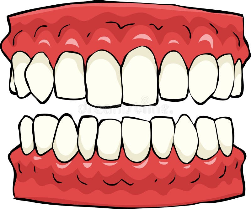 Moulage dentaire 3 illustration stock Moulage dentaire 3 illustration stock