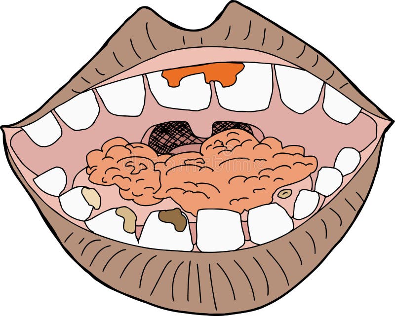 Mouth with Food. 