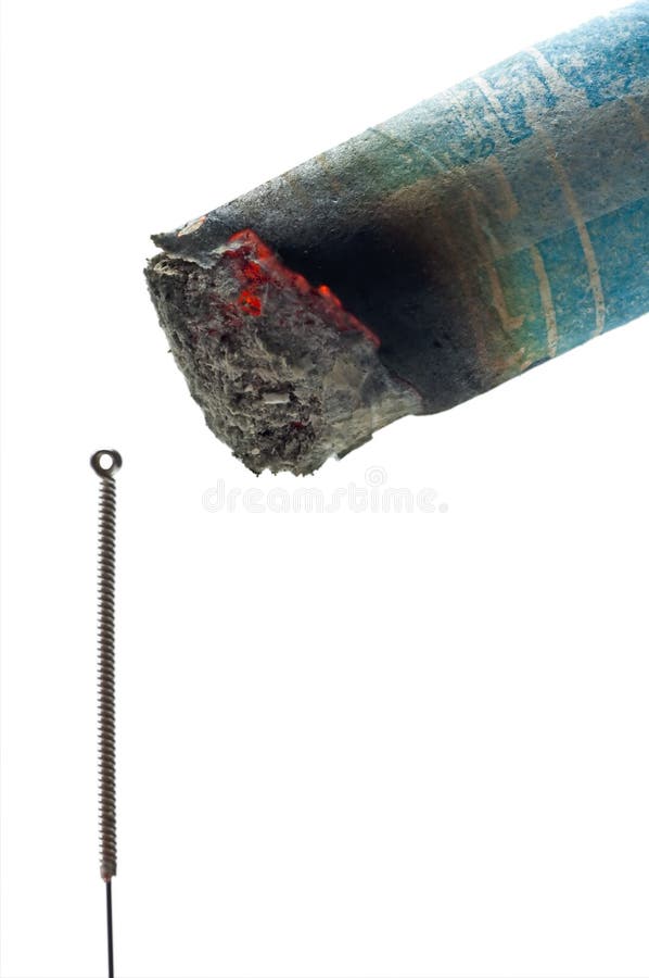 Moxibustion imagen de archivo libre de regalías Moxibustion imagen de archivo libre de regalías