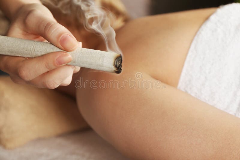 Moxibustion tillvägagångssätt på mitten fotografering för bildbyråer Moxibustion tillvägagångssätt på mitten fotografering för bildbyråer