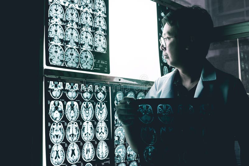 Dementia brain on MRI stock photo. Image of diagnosticed - 99184636