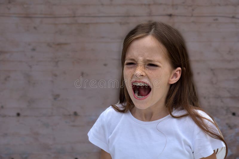 Shouting teenager girl with dental braces. Shouting teenager girl with dental braces