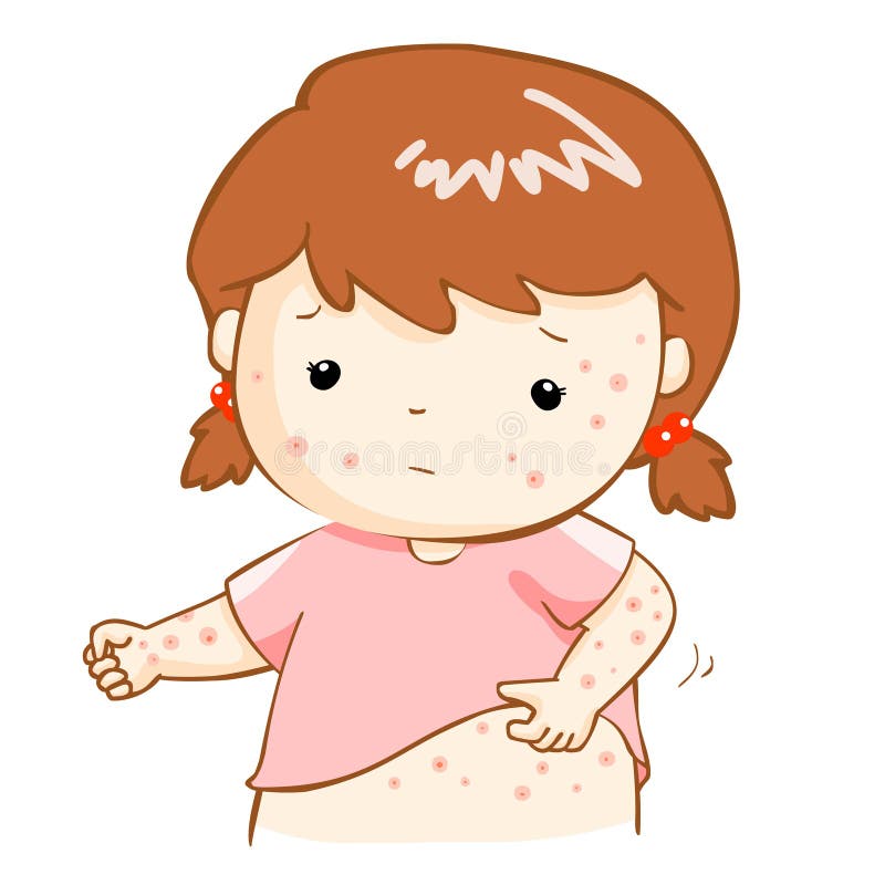 Girl with health problem allergy rash itching. Girl with health problem allergy rash itching