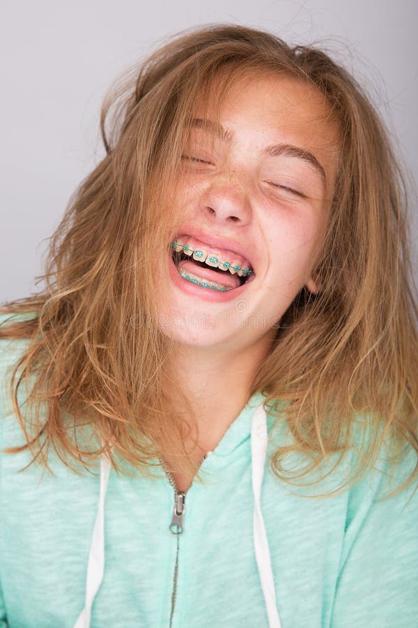 A young girl with messy hair and braces laughing. A young girl with messy hair and braces laughing