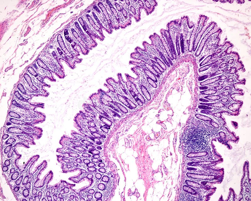 Mucosa layer of the large intestine with LieberkÃ¼hn crypts, lined with numerous goblet cells of pale cytoplasm. The pink layer below is the muscularis mucosae. Human colon. Mucosa layer of the large intestine with LieberkÃ¼hn crypts, lined with numerous goblet cells of pale cytoplasm. The pink layer below is the muscularis mucosae. Human colon.