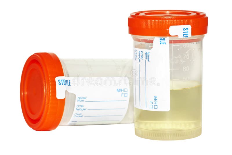 Urine sample collection bottles, one empty and sterile and the other filled with pee to be analyzed isolated on white background. Urine sample collection bottles, one empty and sterile and the other filled with pee to be analyzed isolated on white background.