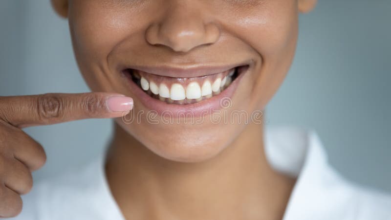 Mujer africana cerrada señala con el dedo a la sonrisa perfecta y blanca