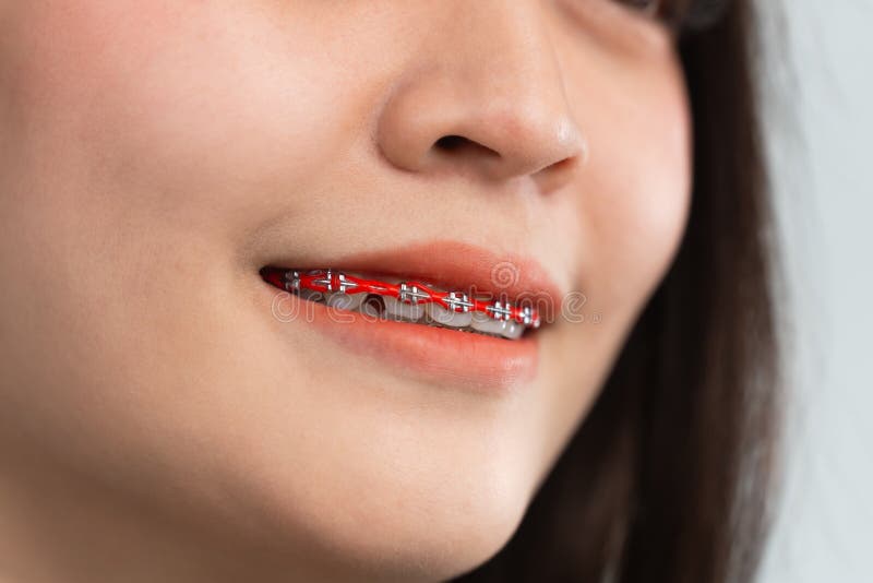 Mujer asiática se prepara. los dientes se cepillan en los dientes blancos de las mujeres para igualar los dientes. sistema de sopo imagen de archivo