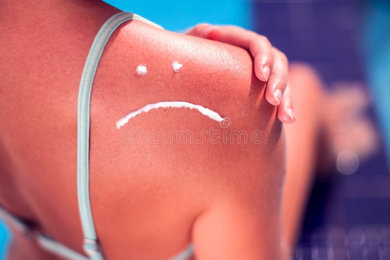 Mujer con crema de la protección del sol en su piel quemada en la forma de la sonrisa triste Concepto del verano, de la atención