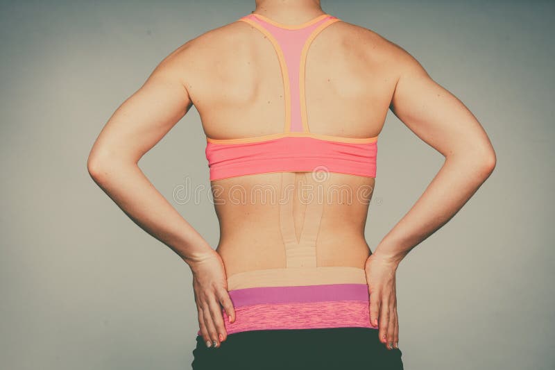 Mujer con kinesio médico pegando en la espalda foto de archivo libre de regalías