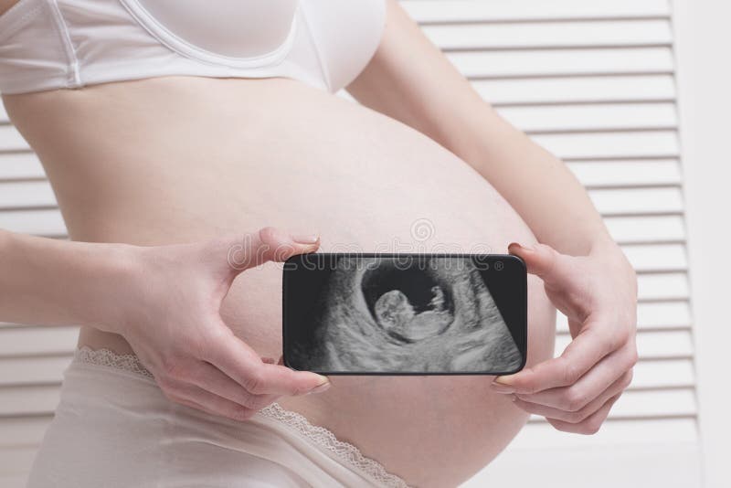 Mujer Embarazada En La Ropa Interior Que Sostiene Y Que Muestra Smartphone Con La Foto Fetal Ultrasonido En El De Panta Imagen de archivo - Imagen de hembra, abdomen: 140662085