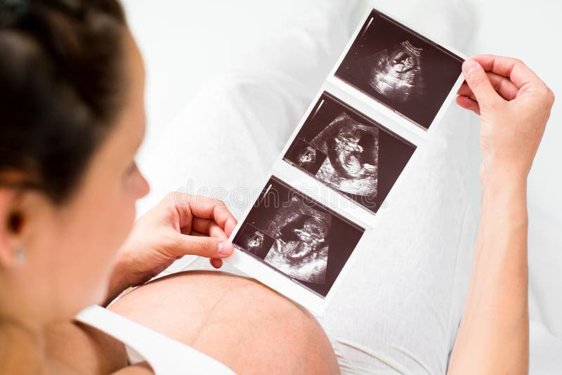 Mujer embarazada que revisa la exploración del ultrasonido del bebé imagen de archivo