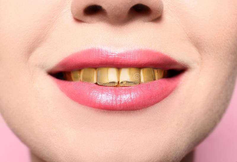 Joven hermosa con dientes de oro fotografía de archivo libre de regalías