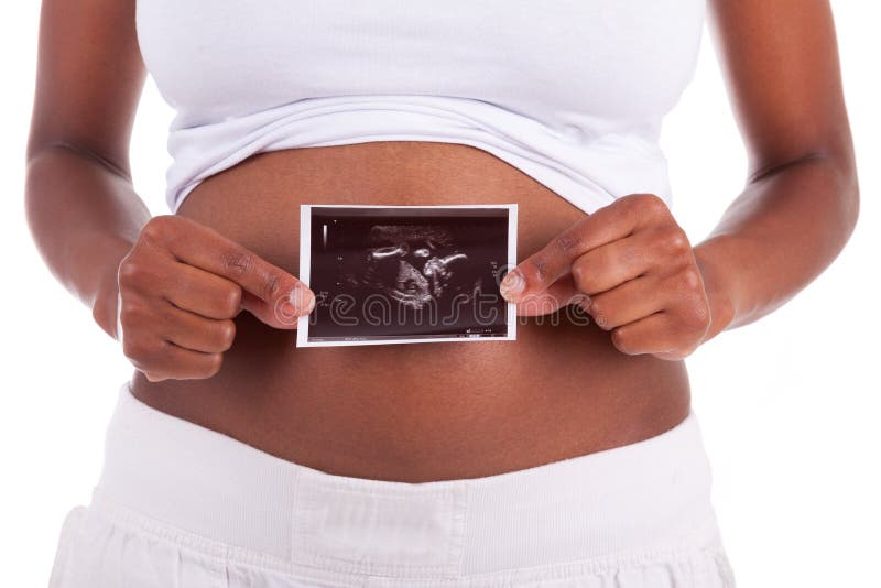 Mujer negra embarazada de los jóvenes que lleva a cabo una imagen del ultrasonido en fron fotos de archivo Mujer negra embarazada de los jóvenes que lleva a cabo una imagen del ultrasonido en fron fotos de archivo