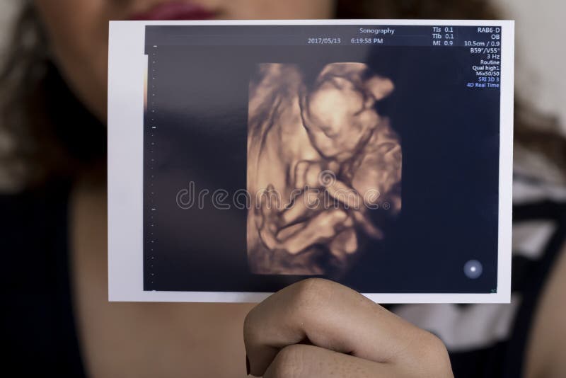 Mujer que lleva a cabo imagen nonata de la sonografía del bebé disponible, delante de fotos de archivo libres de regalías Mujer que lleva a cabo imagen nonata de la sonografía del bebé disponible, delante de fotos de archivo libres de regalías