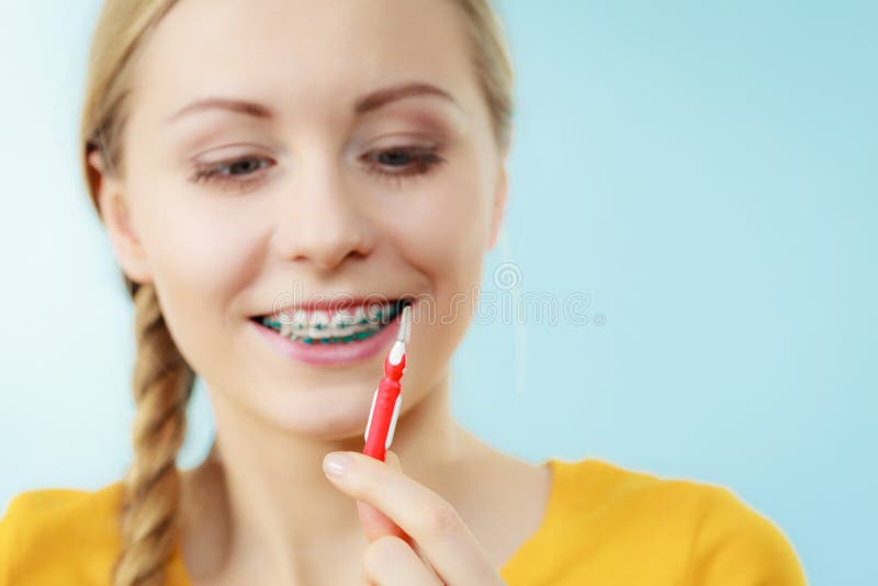 Mulher com cintas dos dentes usando a escova interdental foto de stock royalty free Mulher com cintas dos dentes usando a escova interdental foto de stock royalty free
