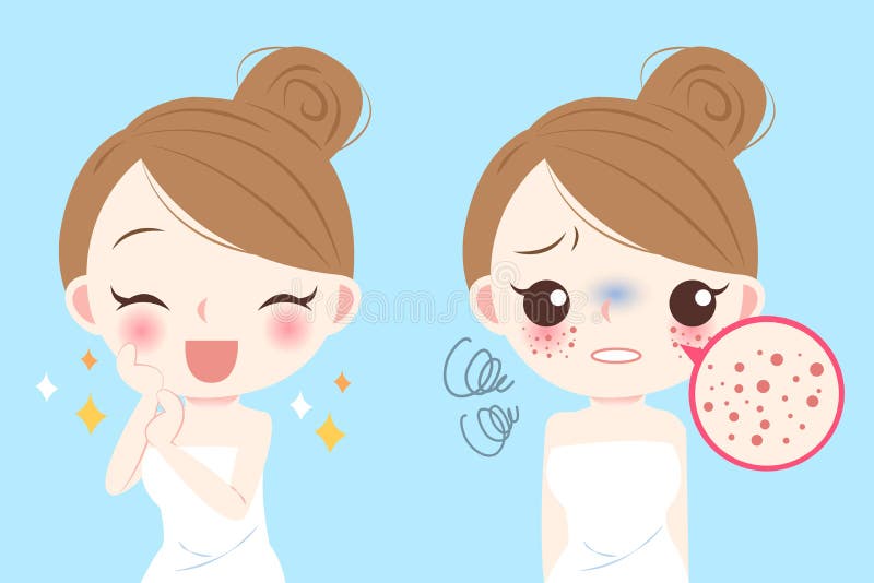 Mulher com problema do skincare ilustração do vetor Mulher com problema do skincare ilustração do vetor