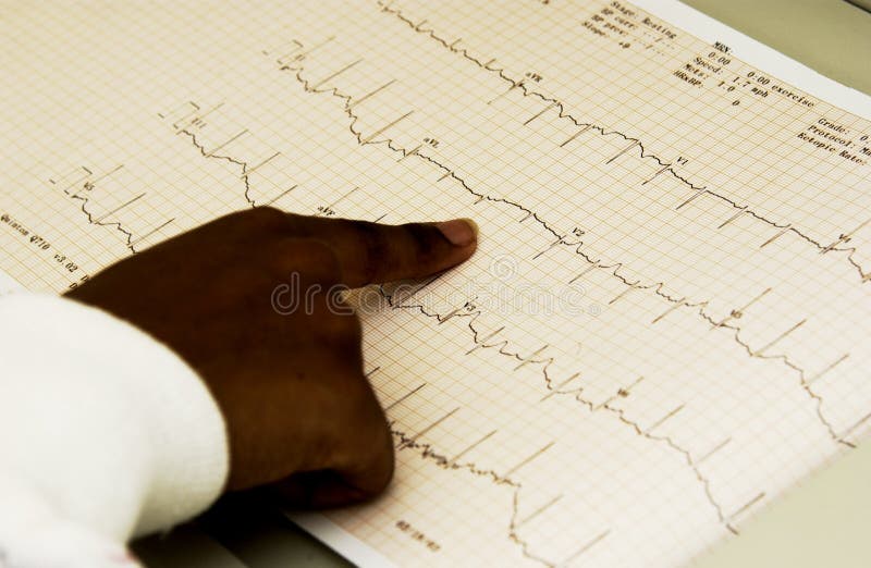 Máquina da monitoração EKG do técnico do americano africano foto de stock royalty free Máquina da monitoração EKG do técnico do americano africano foto de stock royalty free