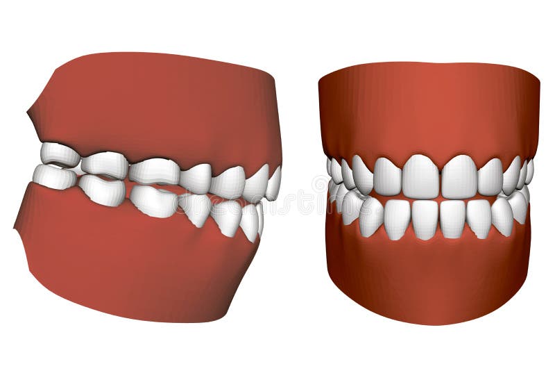 Mâchoire humaine avec des dents illustration de vecteur Mâchoire humaine avec des dents illustration de vecteur