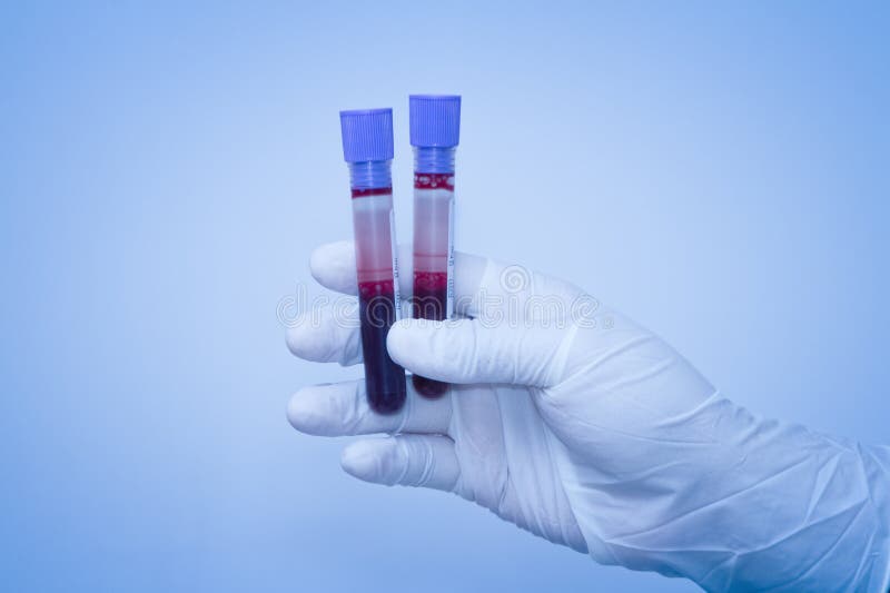 Mão do cientista que toma um tubo da amostra de sangue foto de stock royalty free Mão do cientista que toma um tubo da amostra de sangue foto de stock royalty free