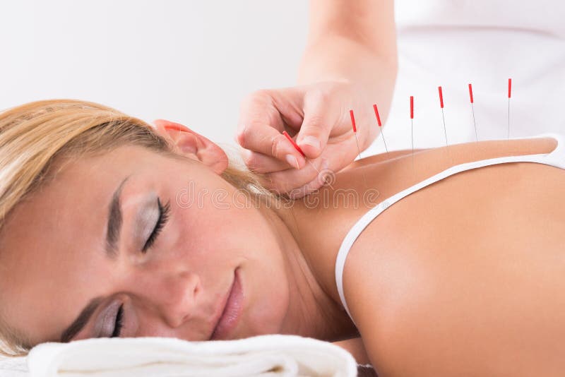 Mão que executa a terapia da acupuntura em Customer& x27; parte traseira de s fotos de stock Mão que executa a terapia da acupuntura em Customer& x27; parte traseira de s fotos de stock