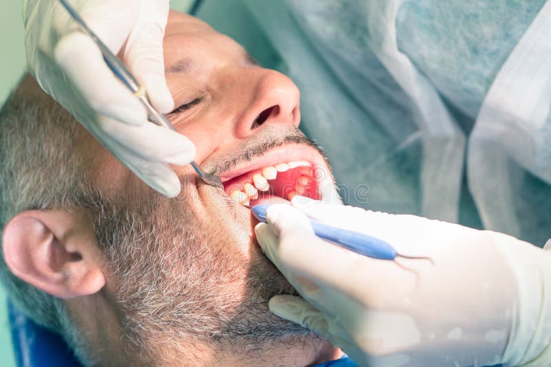 Männlicher Patient während der Mundpflege im Zahnarztbüro