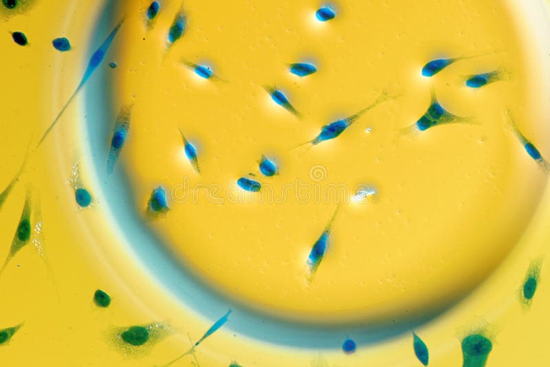 Mänskliga cancerceller för prostata PC-3 royaltyfri bild Mänskliga cancerceller för prostata PC-3 royaltyfri bild