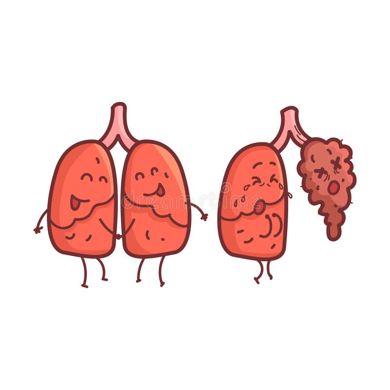 Lungs Human Internal Organ Healthy Vs Unhealthy, Medical Anatomic Funny Cartoon Character Pair In Comparison Happy Against Sick And Damaged. Vector Illustration Humanized Anatomic Elements. Lungs Human Internal Organ Healthy Vs Unhealthy, Medical Anatomic Funny Cartoon Character Pair In Comparison Happy Against Sick And Damaged. Vector Illustration Humanized Anatomic Elements.