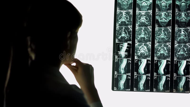 Médecin analysant l'image patiente de balayage, diagnostiquant des problèmes avec le dos, rayon X image stock Médecin analysant l'image patiente de balayage, diagnostiquant des problèmes avec le dos, rayon X image stock