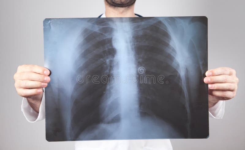 Médico caucasiano a olhar para a xray. exame pulmonar imagem de stock