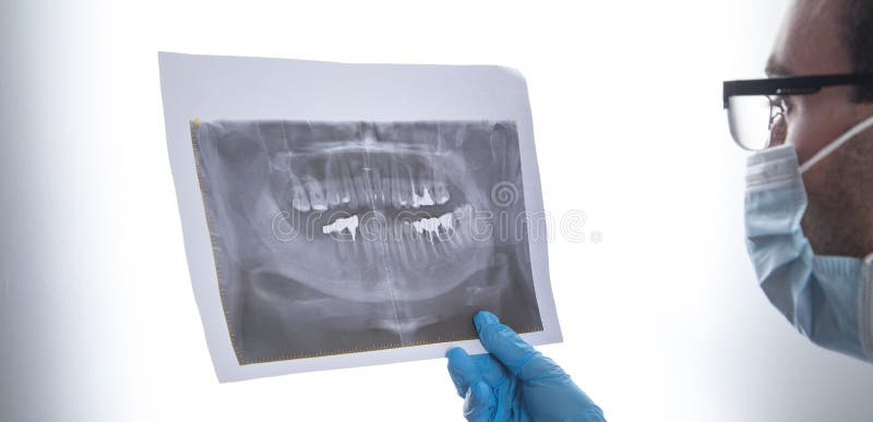 Médico caucasiano segurando a imagem do raio dentário imagem de stock royalty free