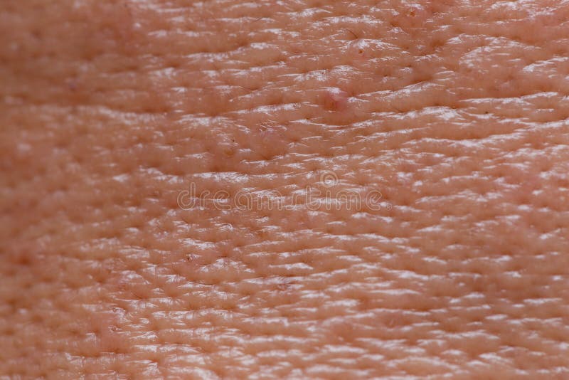 Męskiej twarzy wazeliniarskiej skóry wielcy pores z trądzika makro- strzałem