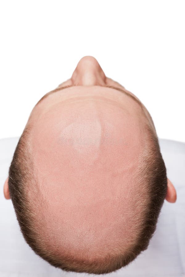 Mężczyzna łysa głowa