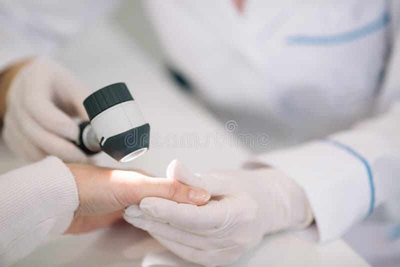 Nahaufnahme der Untersuchungsmole des Dermatologen an Hand der Frau patien lizenzfreies stockfoto Nahaufnahme der Untersuchungsmole des Dermatologen an Hand der Frau patien lizenzfreies stockfoto