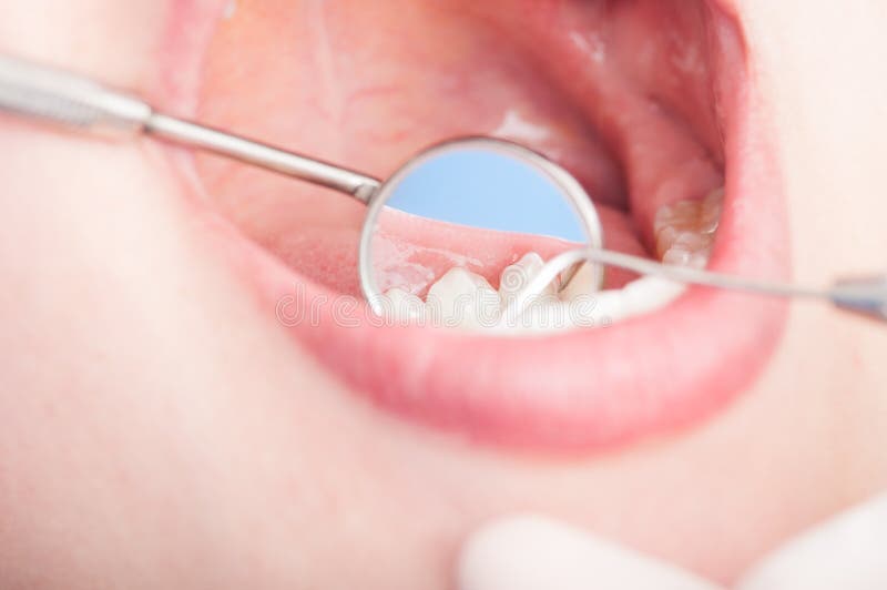 Nahaufnahme der zahnmedizinischen Inspektion mit Orthodontistspiegel stockfotos Nahaufnahme der zahnmedizinischen Inspektion mit Orthodontistspiegel stockfotos