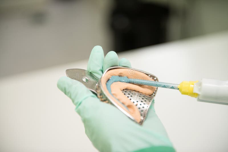 Nahaufnahme-Schuss des Zahnabdrucks mit Implantat stockfoto Nahaufnahme-Schuss des Zahnabdrucks mit Implantat stockfoto
