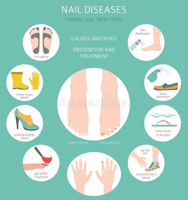 Milady nail disease & disorder | PPT