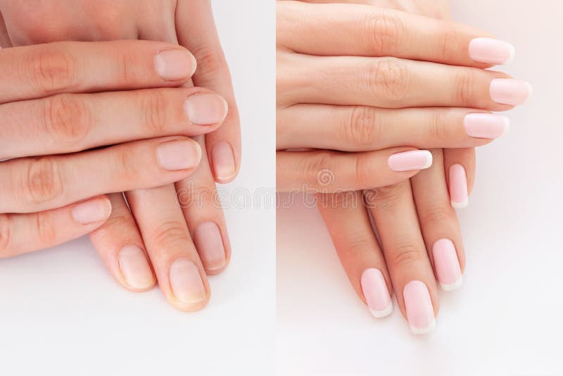 Before and after Nail Extension. Natural French Manicure Stock Image - Image of pink, finger: 213641895 Before and after Nail Extension. Natural French Manicure Stock Image - Image of pink, finger: 213641895